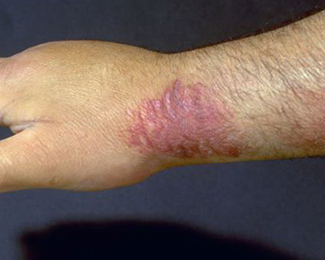 skin problems