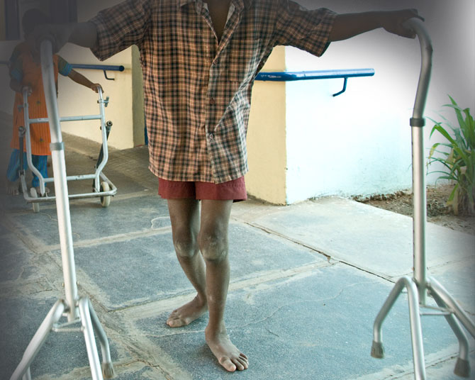 Polio Problems