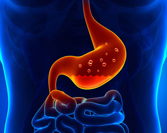 Peptic (ulcer)