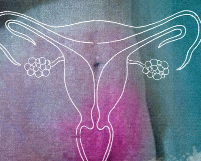 Menstrual Problems