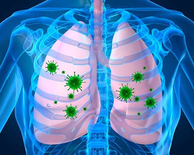 Allergic Rhinitis